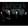 Edema
