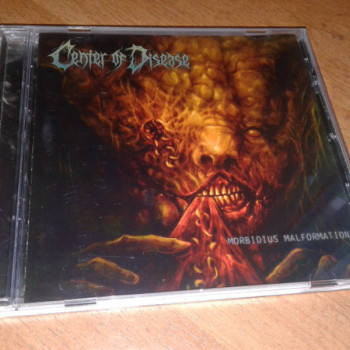 Center Of Disease - Morbidius Malformations