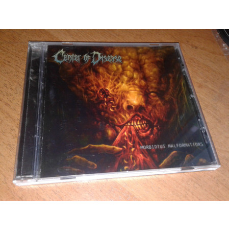 Center Of Disease - Morbidius Malformations